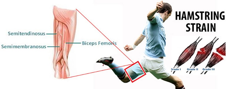 common soccer injuries